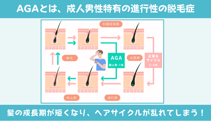 AGAとは