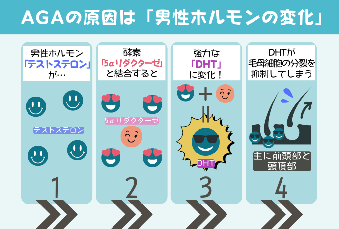 AGAの原因