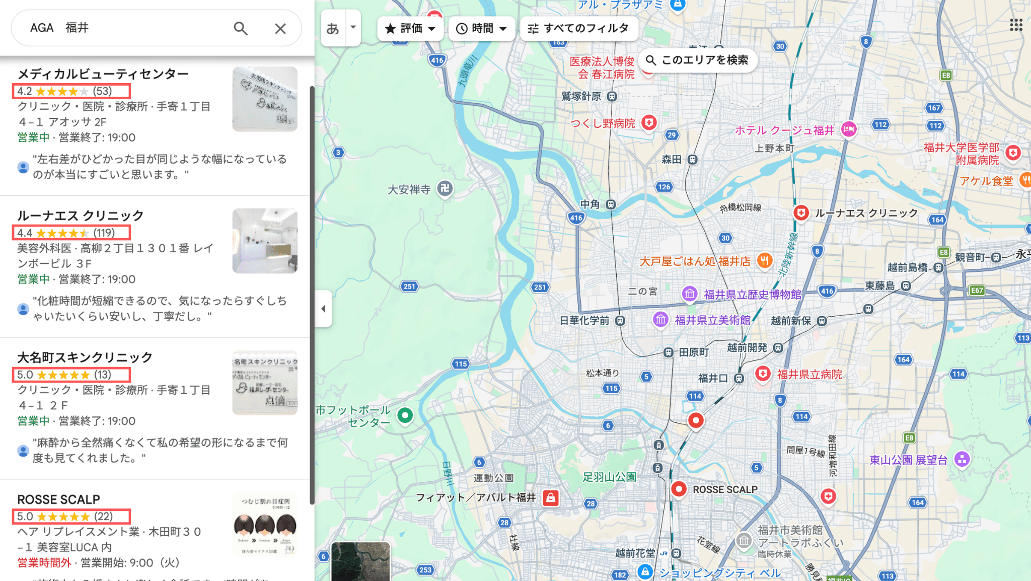 福井でAGA治療におすすめのクリニック