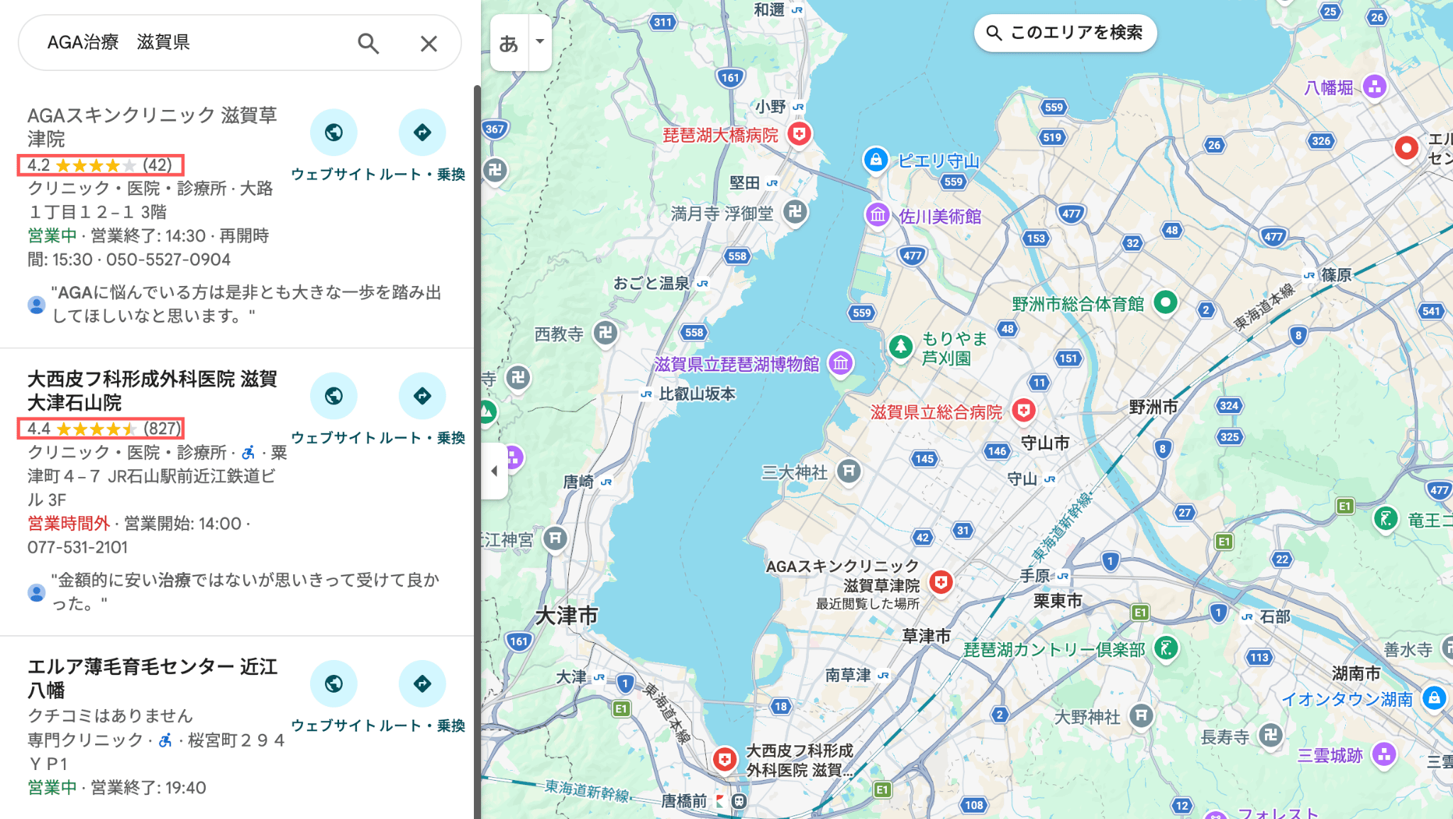 滋賀でAGA治療におすすめのクリニックマップ