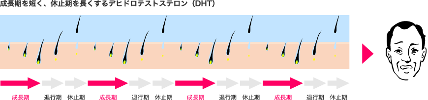 成長期を短く、休止期を長くするでヒドロテストステイン（DHT）