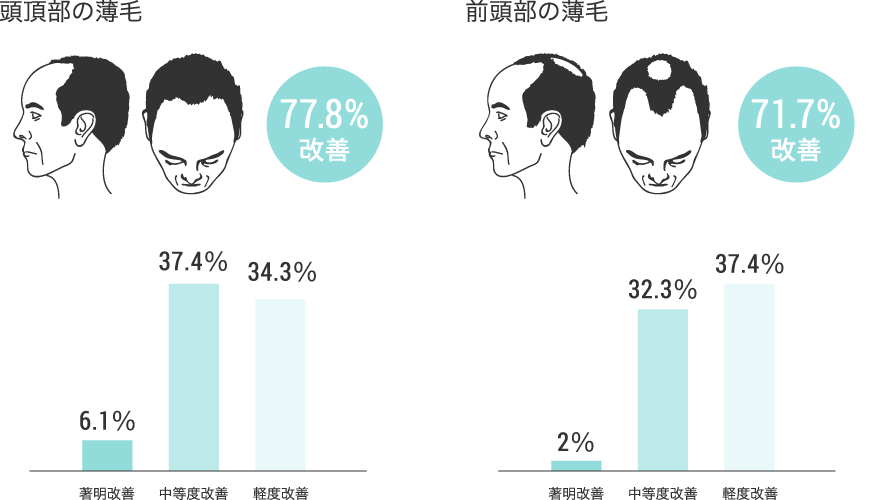 プロペシアの効果比較表