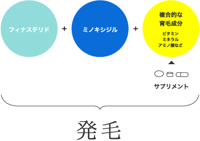 AGAは複合的に治療を必要としています。