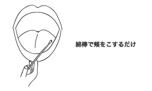 AGA遺伝子検査キットによる検査方法