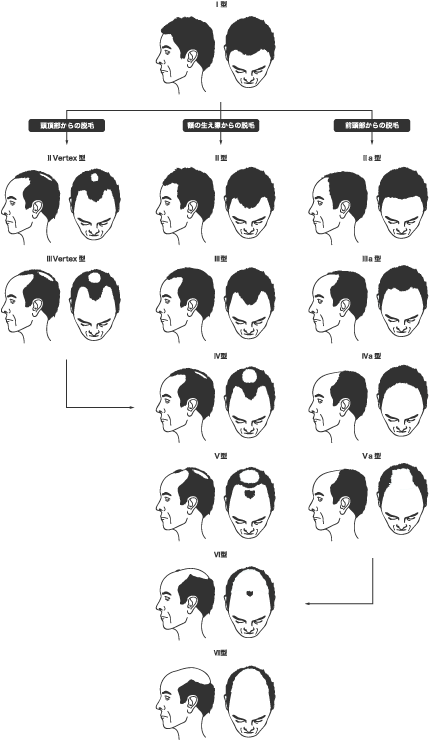 Aga 側 頭 部