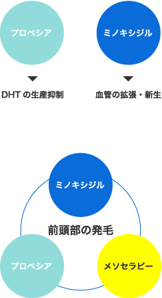 前頭部（生え際）の治療法