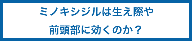 ミノキシジルは生え際や前頭部に効くのか？