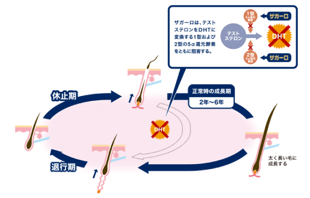 ザガーロによるヘアサイクルへの影響図