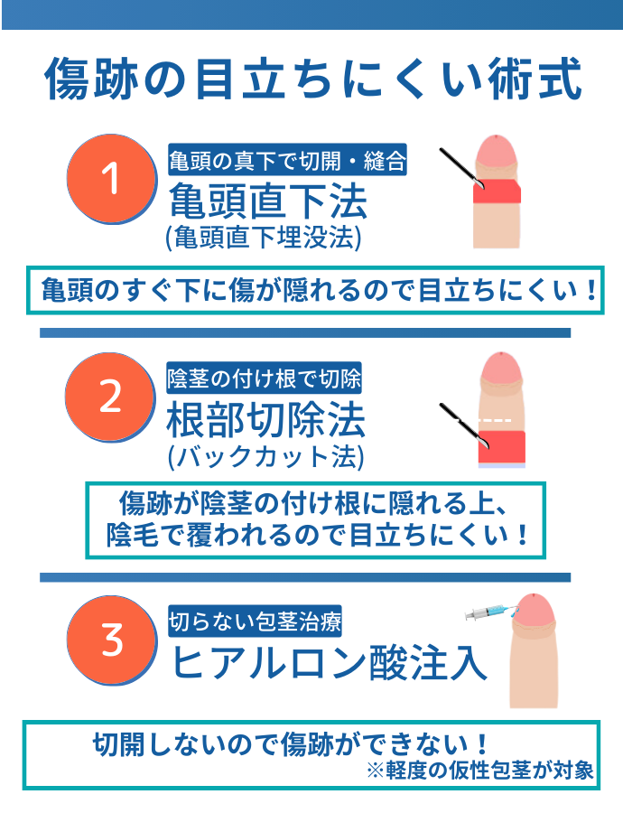 傷跡の目立ちにくい術式