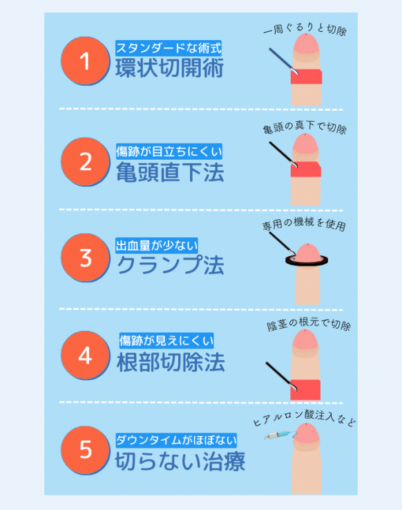 包茎手術の種類
