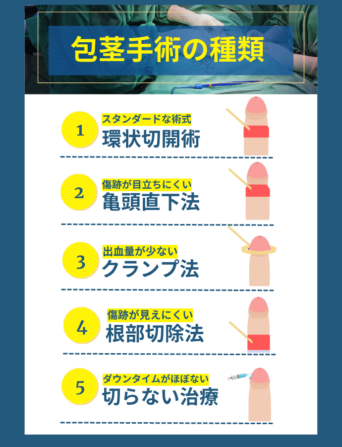 包茎手術の種類