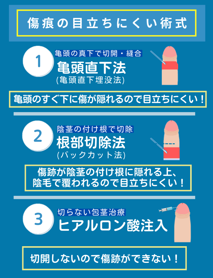 傷痕の目立ちにくい術式