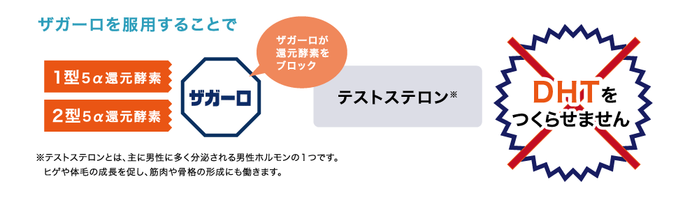 ザガーロを服用することで還元酵素をブロックしてDHTをつくらせません