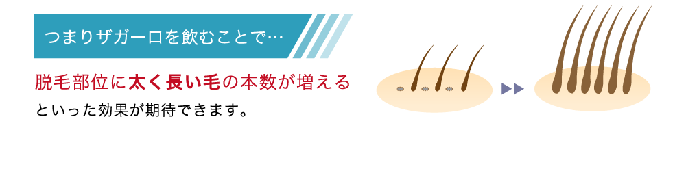 つまりザガーロを飲むことで脱毛部位に太く長い毛の本数が増えるといった効果が期待できます。