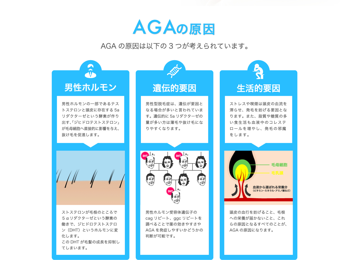 AGAの原因