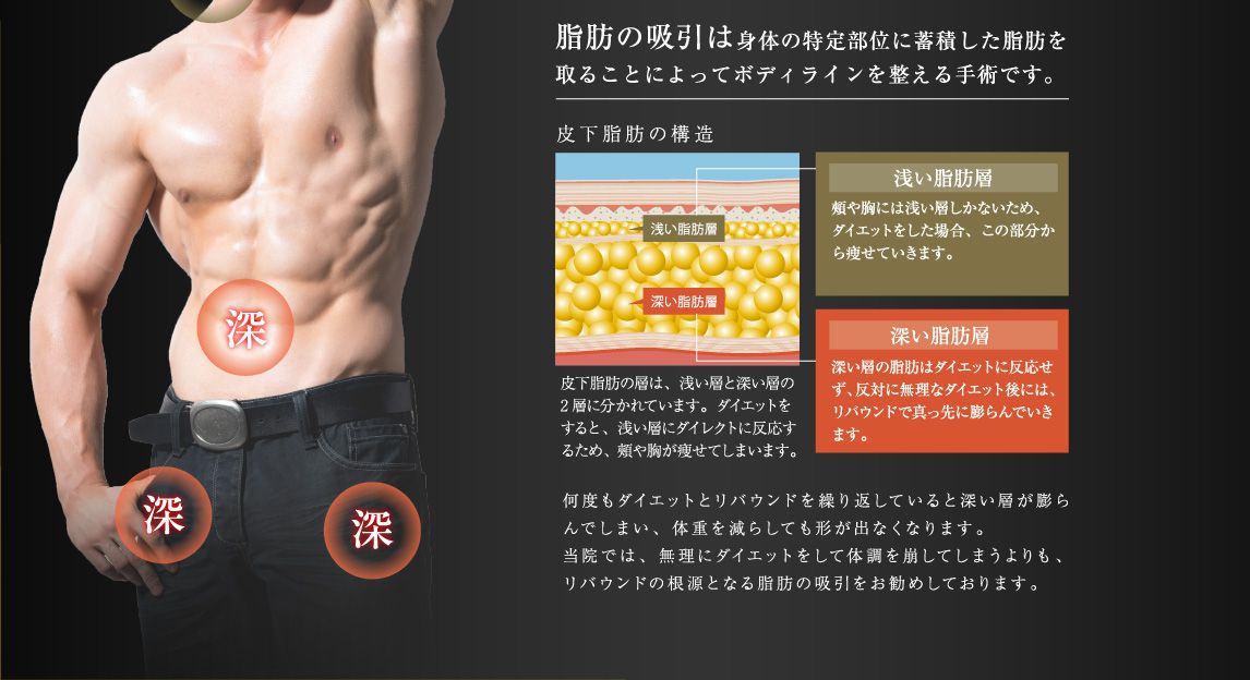脂肪吸引詳細