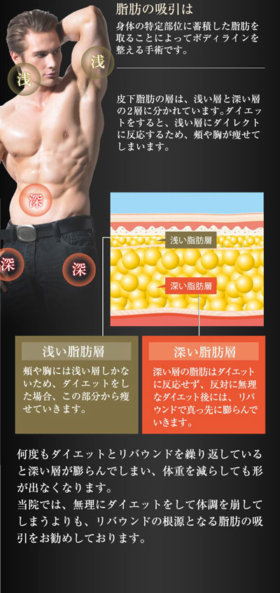 脂肪吸引詳細