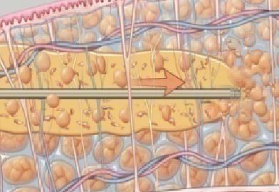 ダウンタイムを短縮