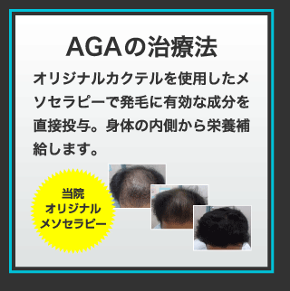 AGAの治療法