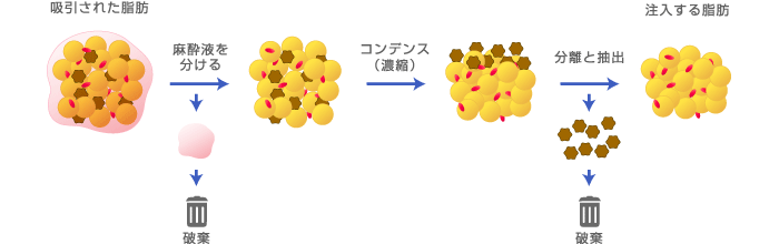 コンデスリッチの流れ